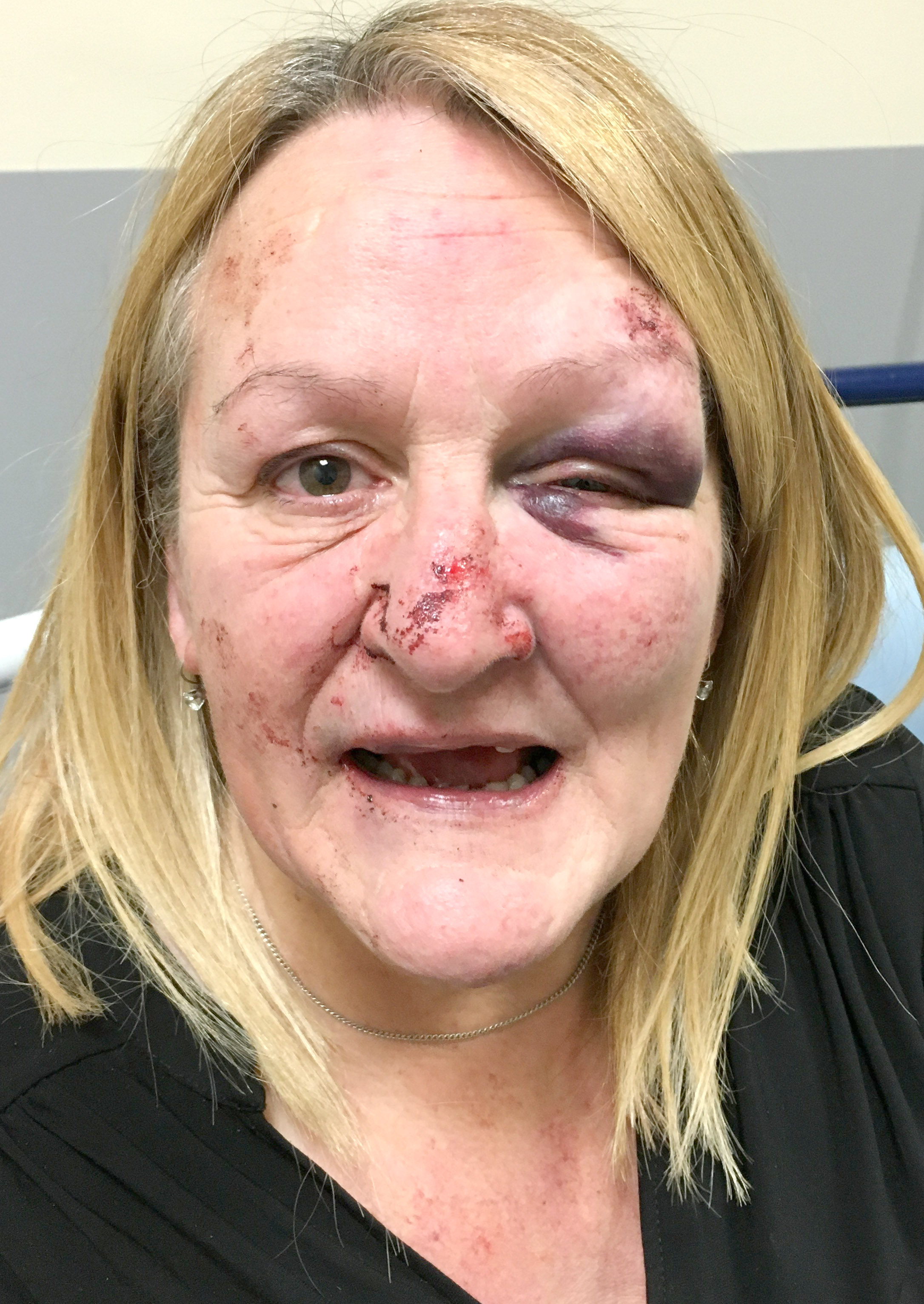 Unprovoked Attack on Two Women